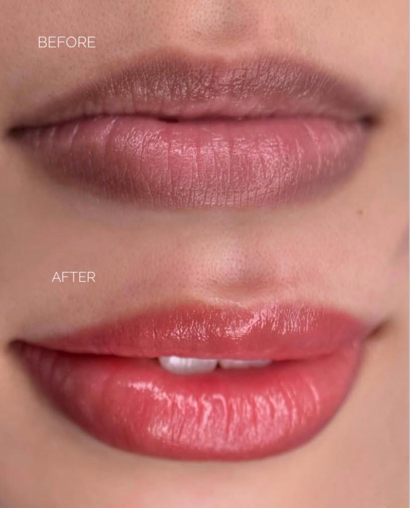lip